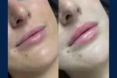 11de2f3f-400a-407d-999c-bbaaa957c31e