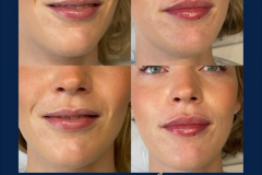 265F4555-E52E-488D-BD06-3CFAC7AFD756