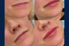 51edd93d-b224-4606-a67a-7131ab7fcab1