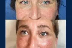 9bc8118d-c834-4b0c-b634-d562b3f83e46