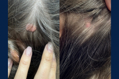 AF81B619-18E6-47E5-ACDF-7AF32BBEAA42