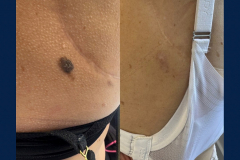 BA37A02D-4B78-4DD1-B160-F60FAF078952